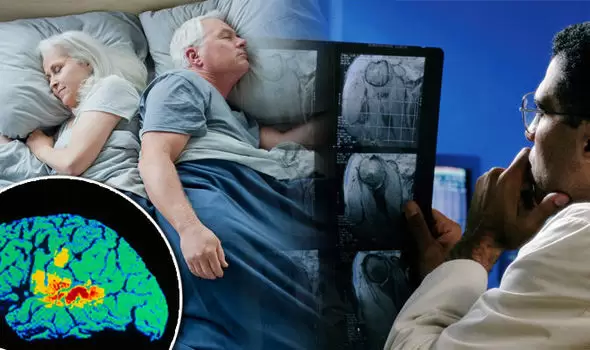 Yuxusuzluq və şəkərli diabet tez-tez Alzeymer xəstəliyindən əvvəl baş verir