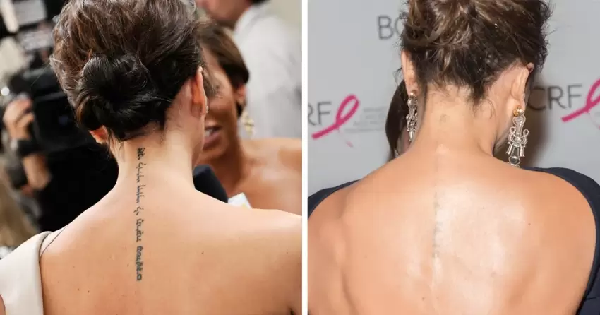 Viktoriya Bekhem bütün döymələrini sildirib