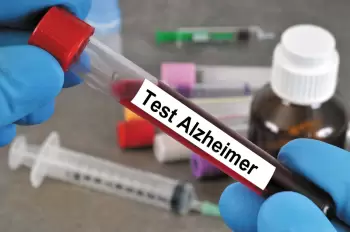 Yeni qan göstəricisi Alzeymer xəstəliyi riskini erkən aşkar etməyə kömək edə bilər