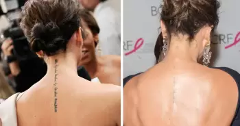 Viktoriya Bekhem bütün döymələrini sildirib